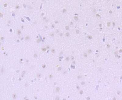 Immunohistochemistry-Paraffin: DKC1 Antibody (JU34-32) [NBP2-75472] - Analysis of paraffin-embedded rat brain tissue using anti-DKC1 antibody. Counter stained with