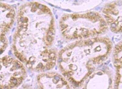 Immunohistochemistry-Paraffin: DKC1 Antibody (JU34-32) [NBP2-75472] - Analysis of paraffin-embedded mouse kidney tissue using DKC1 antibody. Image from verified customer review.