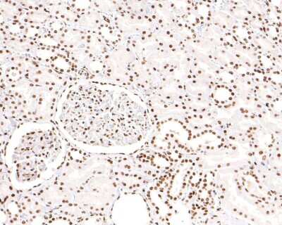 Immunohistochemistry-Paraffin: DKC1 Antibody (JU34-32) [NBP2-75472] - Analysis of paraffin-embedded human kidney tissue with Rabbit anti-DKC1 antibody washed with ddH2O and PBS, and then probed with the primary antibody  at 1/400 dilution for 1 hour at room temperature. The detection was performed using an HRP conjugated compact polymer system. DAB was used as the chromogen. Tissues were counterstained with hematoxylin and mounted with DPX.