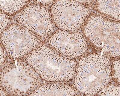Immunohistochemistry-Paraffin: DKC1 Antibody (JU34-32) [NBP2-75472] - Analysis of paraffin-embedded mouse testis tissue with Rabbit anti-DKC1 antibody washed with ddH2O and PBS, and then probed with the primary antibody  at 1/100 dilution for 1 hour at room temperature. The detection was performed using an HRP conjugated compact polymer system. DAB was used as the chromogen. Tissues were counterstained with hematoxylin and mounted with DPX.