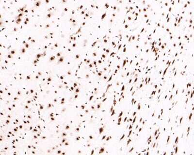 Immunohistochemistry-Paraffin: DKC1 Antibody (JU34-32) [NBP2-75472] - Analysis of paraffin-embedded rat brain tissue with Rabbit anti-DKC1 antibody washed with ddH2O and PBS, and then probed with the primary antibody  at 1/400 dilution for 1 hour at room temperature. The detection was performed using an HRP conjugated compact polymer system. DAB was used as the chromogen. Tissues were counterstained with hematoxylin and mounted with DPX.