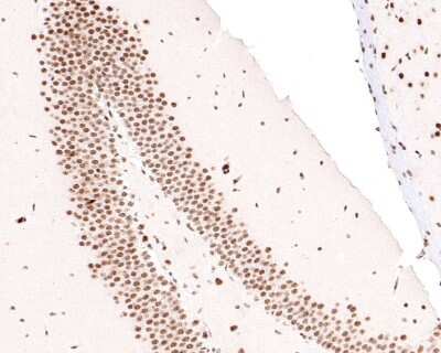 Immunohistochemistry-Paraffin: DKC1 Antibody (JU34-32) [NBP2-75472] - Analysis of paraffin-embedded mouse hippocampus tissue with Rabbit anti-DKC1 antibody washed with ddH2O and PBS, and then probed with the primary antibody  at 1/400 dilution for 1 hour at room temperature. The detection was performed using an HRP conjugated compact polymer system. DAB was used as the chromogen. Tissues were counterstained with hematoxylin and mounted with DPX.