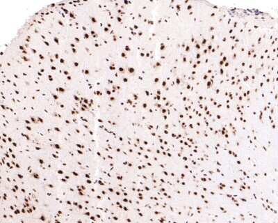 Immunohistochemistry-Paraffin: DKC1 Antibody (JU34-32) [NBP2-75472] - Analysis of paraffin-embedded mouse brain tissue with Rabbit anti-DKC1 antibody washed with ddH2O and PBS, and then probed with the primary antibody at 1/400 dilution for 1 hour at room temperature. The detection was performed using an HRP conjugated compact polymer system. DAB was used as the chromogen. Tissues were counterstained with hematoxylin and mounted with DPX.