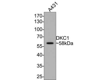 Western Blot: DKC1 Antibody (JU34-32) [NBP2-75472] - Analysis of DKC1 on A431 cell lysates with Rabbit anti-DKC1 antibody at 1/500 dilution. Lysates/proteins at 10 ug/Lane. Predicted band size: 58 kDa Observed band size: 58 kDa Exposure time: 1 minute; 10% SDS-PAGE gel. Proteins were transferred to a PVDF membrane and blocked with 5% NFDM/TBST for 1 hour at room temperature. The primary antibody at 1/500 dilution was used in 5% NFDM/TBST at room temperature for 2 hours. Goat Anti-Rabbit IgG - HRP Secondary Antibody at 1:200,000 dilution was used for 1 hour at room temperature.