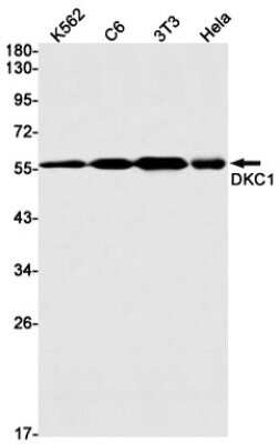 Western Blot: DKC1 Antibody (S02-2D8) [NBP3-14925] - Western blot detection of DKC1 in K562, C6, 3T3, Hela cell lysates using DKC1 Rabbit mAb (1:1000 diluted). Predicted band size: 58kDa. Observed band size: 58kDa.