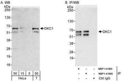 Western Blot: DKC1 Antibody [NBP1-41064] - Whole cell lysate from HeLa (5, 15 and 50 mcg for WB; 1 mg for IP, 20% of IP loaded) and 293T (T; 50 mcg) cells.  Affinity purified rabbit anti-DKC1 antibody used for WB at 0.04 mcg/ml (A) and 1 mcg/ml (B) and used for IP at 10 mcg/mg lysate.  DKC1 was also immunoprecipitated by rabbit anti-DKC1 antibody NBP!-41065, which recognizes a downstream epitope.