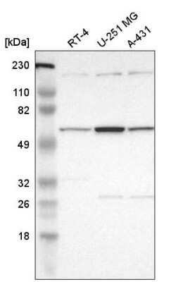 Western Blot: DKC1 Antibody [NBP2-55221] - Analysis in human cell line RT-4, human cell line U-251 MG and human cell line A-431.