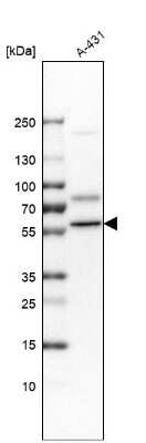 Western Blot: DKC1 Antibody [NBP2-55221] - Analysis in human cell line A-431.