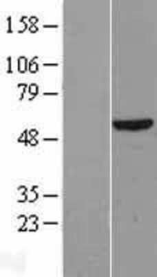 Western Blot: DKC1 Overexpression Lysate (Adult Normal) [NBL1-09897] Left-Empty vector transfected control cell lysate (HEK293 cell lysate); Right -Over-expression Lysate for DKC1.