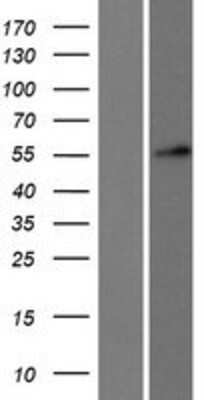 Western Blot: DKC1 Overexpression Lysate (Adult Normal) [NBP2-09647] Left-Empty vector transfected control cell lysate (HEK293 cell lysate); Right -Over-expression Lysate for DKC1.