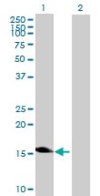 Western Blot: DKFZp761H1710 Antibody [H00083459-B01P] - Analysis of LOC83459 expression in transfected 293T cell line by LOC83459 polyclonal antibody.  Lane 1: DKFZP761H1710 transfected lysate(19.8 KDa). Lane 2: Non-transfected lysate.
