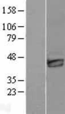 Western Blot: DKK3 Overexpression Lysate (Adult Normal) [NBP2-08675] Left-Empty vector transfected control cell lysate (HEK293 cell lysate); Right -Over-expression Lysate for DKK3.