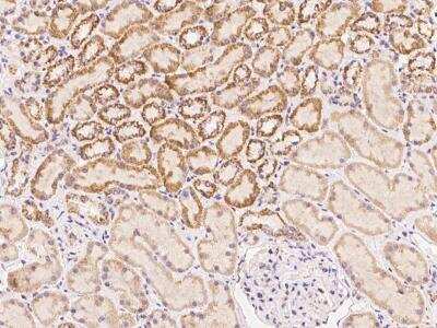 Immunohistochemistry-Paraffin DLC1/DLEC1 Antibody - BSA Free