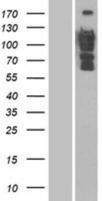 Western Blot: DLC1 Overexpression Lysate (Adult Normal) [NBP2-04827] Left-Empty vector transfected control cell lysate (HEK293 cell lysate); Right -Over-expression Lysate for DLC1.
