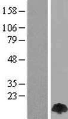 Western Blot: DLC8 Overexpression Lysate (Adult Normal) [NBP2-10622] Left-Empty vector transfected control cell lysate (HEK293 cell lysate); Right -Over-expression Lysate for DLC8.