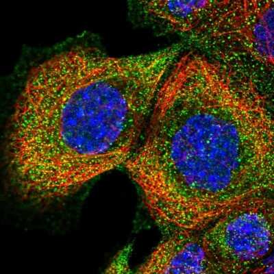 Immunocytochemistry/Immunofluorescence: DLEU1 Antibody [NBP2-55430] - Staining of human cell line A-431 shows localization to plasma membrane & cytosol.