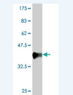 Western Blot: DLG1 Antibody (1B12) [H00001739-M03] - Detection against Immunogen (35.64 KDa) .