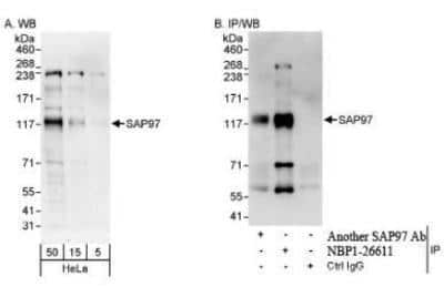 Western Blot: DLG1 Antibody [NBP1-26611] - Whole cell lysate (5, 15 and 50 mcg for WB; 1 mg for IP, 20% of IP loaded) from HeLa cells.  Affinity purified rabbit anti-SAP97 used for WB at 0.04 mcg/ml (A) and 0.4 mcg/ml (B) and used for IP at 10 mcg/mg lysate.  SAP97 was also immunoprecipitated by another rabbit anti-SAP97 antibody, which recognizes a downstream epitope.