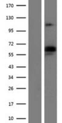 Western Blot: DLG1 Overexpression Lysate (Adult Normal) [NBP2-07915] Left-Empty vector transfected control cell lysate (HEK293 cell lysate); Right -Over-expression Lysate for DLG1.