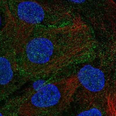 Immunocytochemistry/Immunofluorescence: DLG5 Antibody [NBP2-55619] - Staining of human cell line HaCaT shows localization to cell junctions.