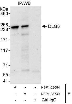 Immunoprecipitation: DLG5 Antibody [NBP1-28694] - Samples: Whole cell lysate (1 mg for IP, 20% of IP loaded) from HeLa cells.   Antibodies: Affinity purified rabbit anti-DLG5 antibody NBP1-28694 used for IP at 10 ug/mg lysate.  DLG5 was also immunoprecipitated by rabbit anti-DLG5 antibody NBP1-28739, which recognizes a downstream epitope.  For blotting immunoprecipitated DLG5, NBP1-28739 was used at 1 ug/ml.  Detection: Chemiluminescence with an exposure time of 30 seconds.