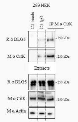 Immunoprecipitation DLG5 Antibody