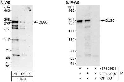 Western Blot DLG5 Antibody