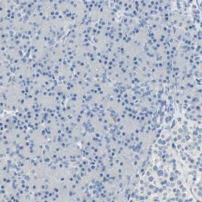 Immunohistochemistry-Paraffin DLG7/HURP Antibody