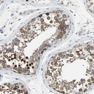 Immunohistochemistry-Paraffin DLG7/HURP Antibody