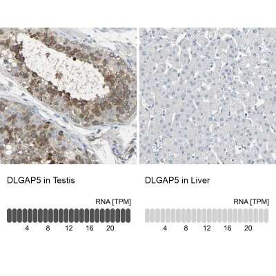 Immunohistochemistry-Paraffin: DLG7/HURP Antibody [NBP1-87976] - Analysis in human testis and liver tissues using NBP1-87976 antibody. Corresponding DLGAP5 RNA-seq data are presented for the same tissues.