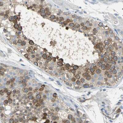 Immunohistochemistry-Paraffin: DLG7/HURP Antibody [NBP1-87976] - Staining of human testis shows moderate cytoplasmic positivity in cells in seminiferous ducts.