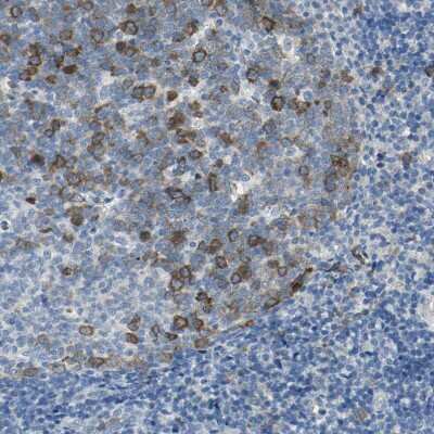 Immunohistochemistry-Paraffin: DLG7/HURP Antibody [NBP1-87976] - Staining of human tonsil shows moderate cytoplasmic positivity in germinal center cells.