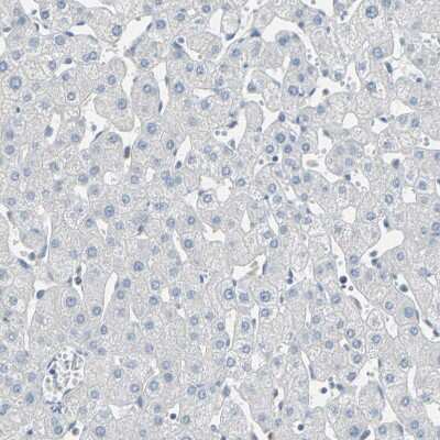 Immunohistochemistry-Paraffin: DLG7/HURP Antibody [NBP1-87976] - Staining of human liver shows no positivity in hepatocytes as expected.