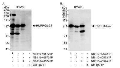 Immunoprecipitation: DLG7/HURP Antibody [NB110-40572] - Detection of Human HURP/DLG7 by Western Blot of  Immunoprecipitates. Samples:  Whole cell lysate (1 mg for IP,  20% of IP loaded) from HeLa cells.  Antibodies:  Affinity purified  rabbit anti-HURP/DLG7 antibody NB110-40572 used for IP at 3 mcg/mg lysate. HURP/DLG7 was  also immunoprecipitated by rabbit anti-HURP/DLG7 antibodies  NB110-40573 and NB110-40574, which recognize other epitopes.  Detection:  Chemiluminescence with exposure times of 10 seconds (A and  B).