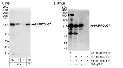 <b>Independent Antibodies Validation and Biological Strategies Validation.</b>Western Blot: DLG7/HURP Antibody [NB110-40573] - Detection of Human HURP/DLG7 on HeLa whole cell lysate using NB110-40573. HURP/DLG7 was also immunoprecipitated by rabbit anti-HURP/DLG7 antibodies NB110-40572 and NB110-40574.