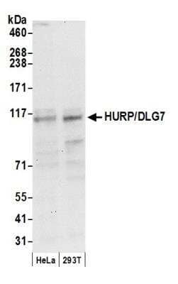 Western Blot DLG7/HURP Antibody