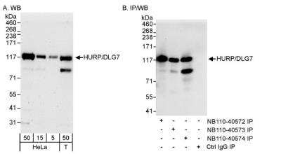 Western Blot: DLG7/HURP Antibody [NB110-40574] - Detection of Human HURP/DLG7 on HeLa whole cell lysate using NB110-40574. HURP/DLG7 was also immunoprecipitated by rabbit anti-HURP/DLG7 antibodies NB110-40572 and NB110-40573.