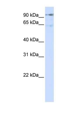 Western Blot: DLG7/HURP Antibody [NBP1-54640] - Transfected 293T cell lysate, concentration 0.2-1 ug/ml.