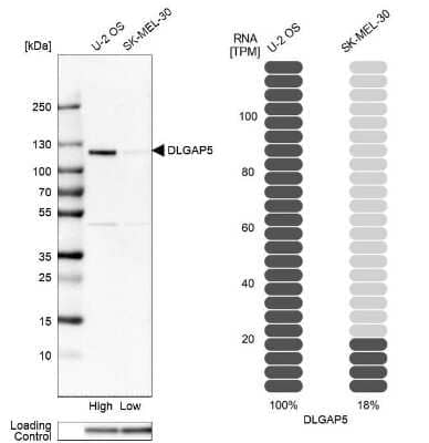 Western Blot DLG7/HURP Antibody