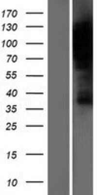 Western Blot DLG7/HURP Overexpression Lysate