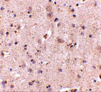 Immunohistochemistry: DLGAP2 Antibody [NBP2-82086] - Immunohistochemistry of DLGAP2 in human brain with DLGAP2 antibody at 5 ug/mL.
