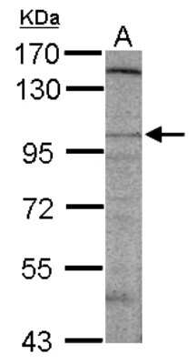 Western Blot: DLGAP2 Antibody [NBP2-16175] - Sample (50 ug of whole cell lysate) A: Mouse Brain, 7. 5% SDS PAGE gel, diluted at 1:500.