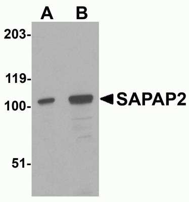 Western Blot: DLGAP2 Antibody [NBP2-82086] - Analysis of DLGAP2 in Raji cell lysate with DLGAP2 antibody at (A) 0.5 and (B) 1 ug/ml.