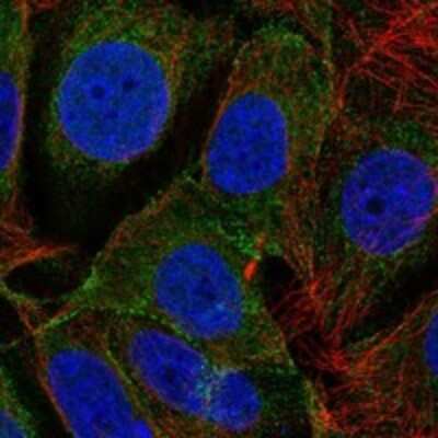 Immunocytochemistry/Immunofluorescence: DLGAP3 Antibody [NBP3-17241] - Staining of human cell line MCF7 shows localization to plasma membrane & endoplasmic reticulum.