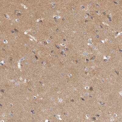 Immunohistochemistry-Paraffin: DLGAP3 Antibody [NBP1-90601] - Staining of human cerebral cortex shows high expression.
