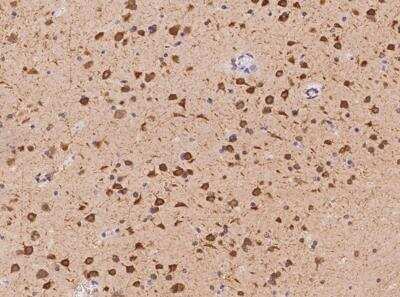 Immunohistochemistry-Paraffin: DLGAP3 Antibody [NBP3-05977] - Staining of human DLGAP3 in human brain with rabbit polyclonal antibody at 1:100 dilution.