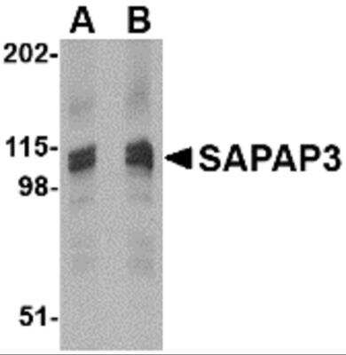 Western Blot: DLGAP3 Antibody [NBP2-81713] - Analysis of DLGAP3 in rat brain tissue lysate with DLGAP3 antibody at (A) 1 and (B) 2 ug/ml.