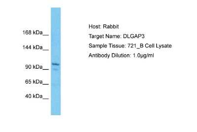 Western Blot: DLGAP3 Antibody [NBP2-82862] - Host: Rabbit. Target Name: DLGAP3. Sample Type: 721_B Whole Cell lysates. Antibody Dilution: 1.0ug/ml