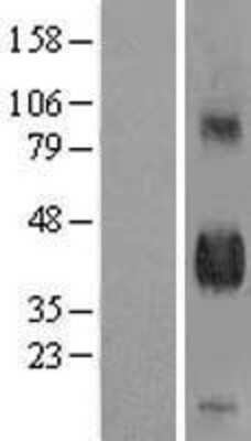 Western Blot Pref-1/DLK1/FA1 Overexpression Lysate