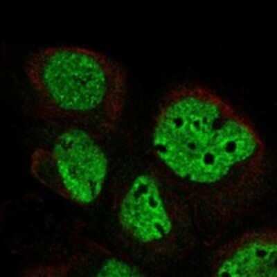 Immunocytochemistry/Immunofluorescence: DLK2/EGFL9 Antibody [NBP3-17831] - Staining of human cell line A-431 shows localization to nucleoplasm.